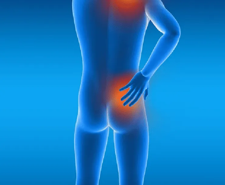 Dolor lumbar